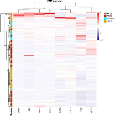 Molecular characterization of epithelial-mesenchymal transition and medical treatment related-genes in non-functioning pituitary neuroendocrine tumors